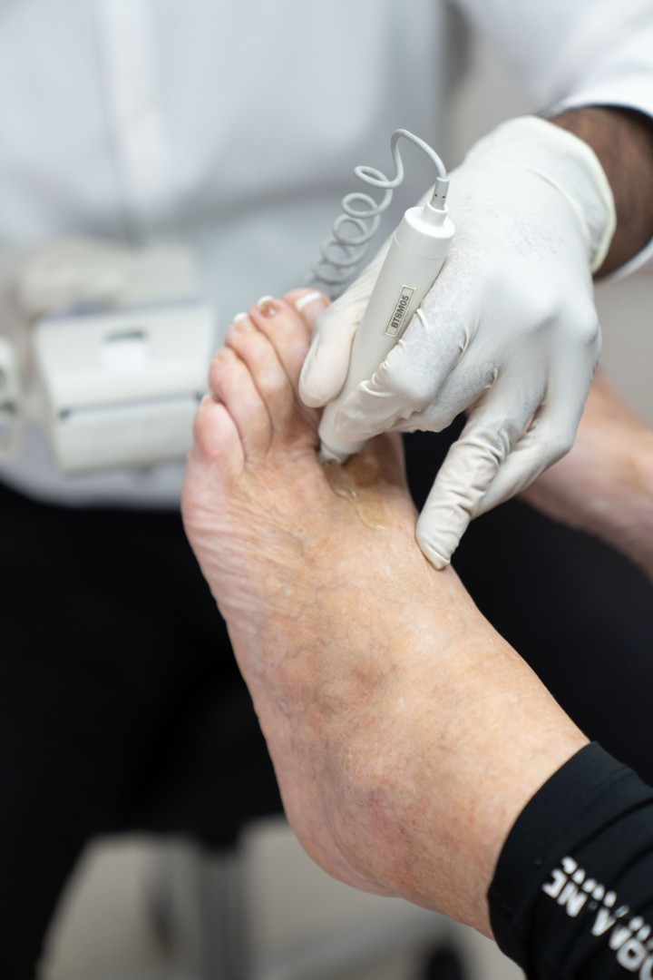 Podiatrist treating patient’s foot with handheld device